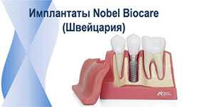 Nobel — технология лечения и протезирования зубов в клинике Бондаревых